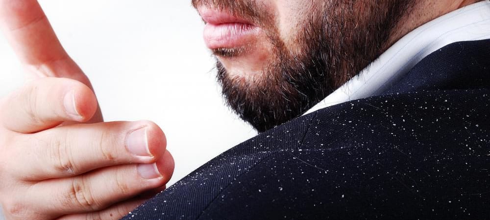 Men’s Grooming Problems: Flaky Scalp & How To Combat It