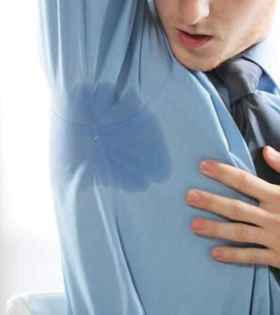 How Can I Stop Sweating So Much?