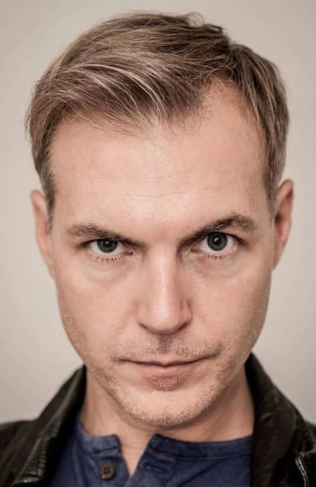Receding Hair With Widow's Peak