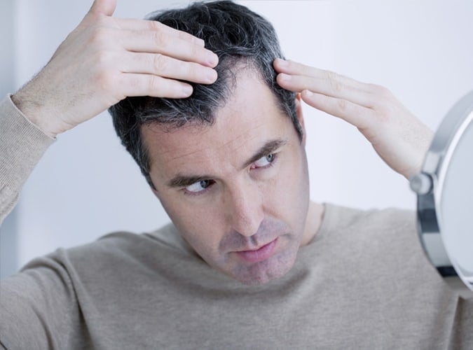Man checking hairline