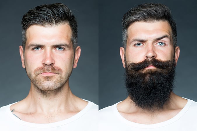 Man facial hair before after