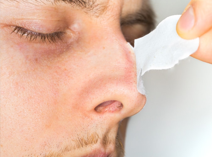 pore strips