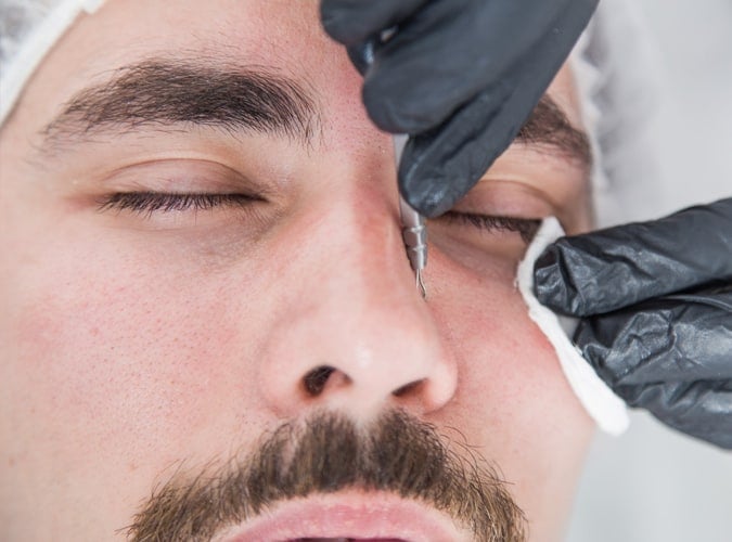 beautician removing black heads