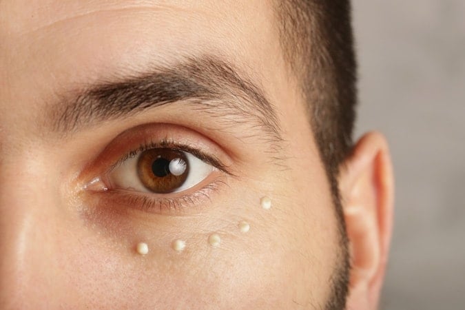 Eye Creams for Dark Circles