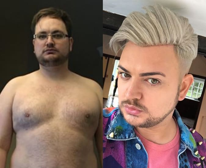 https://iviaggidelcaruggio.com/wp-content/uploads/2019/07/surgery-liam1.jpg