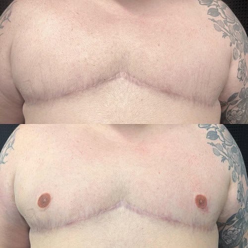 3D Nipple Tattoo