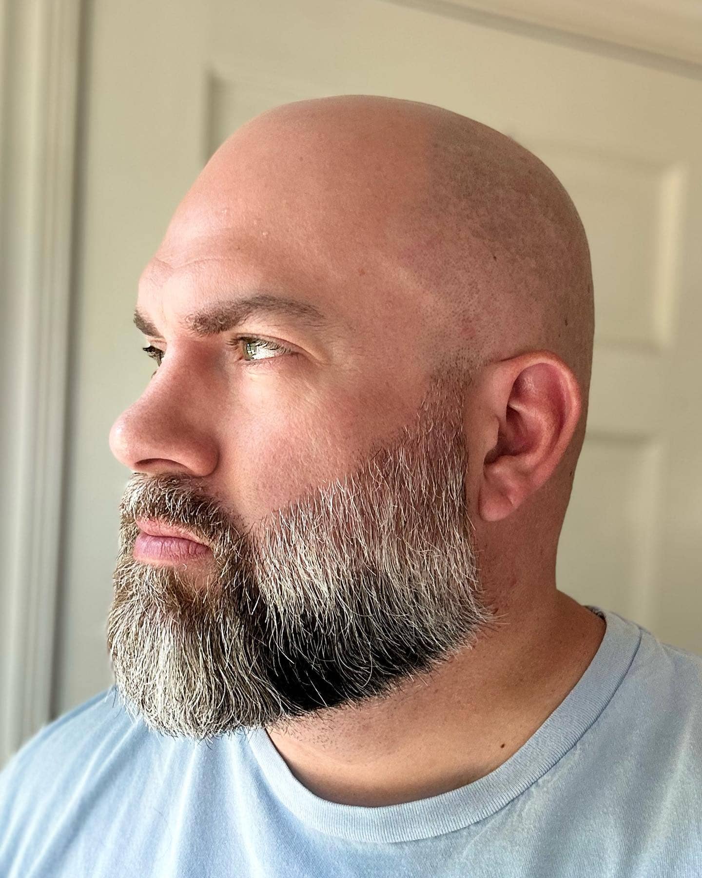man with a freshly shaved head