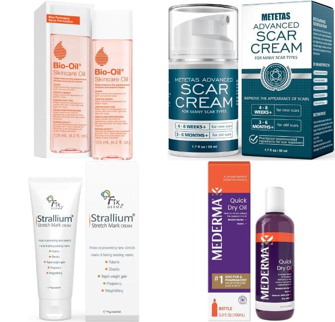 The best products for men's stretch marks